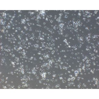 Rat Neurons-forebrain (RN-fb)-Phase Contrast, 100X