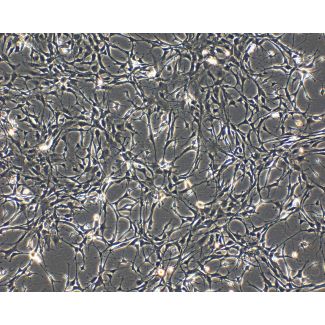 Rat Pituitary Cells (RPC) - Phase contrast, 100x.
