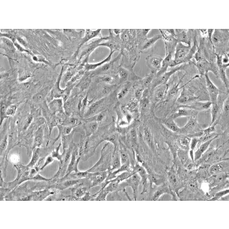 Rat Pulmonary Fibroblasts (RPF) - Phase contrast, 200x.
