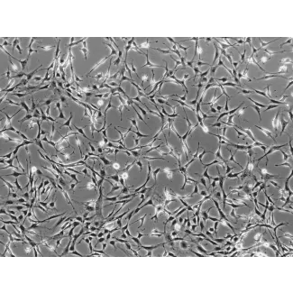 Rat Salivary Gland Fibroblasts (RSGF) - Phase contrast, 100x.

