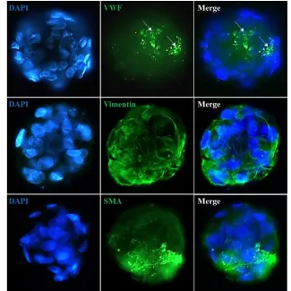 Immunostaining of the hepatic stellate cell-sinusoidal endothelial cell co-culture spheroids with the stellate cell markers (Vimentin and Smooth Muscle Actin) and the endothelial cell marker Von Willebrand Factor . 