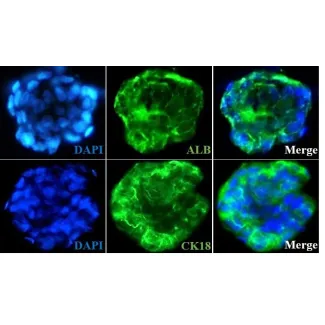 Day 7; Immunostaining of the hepatocyte-stellate cell co-culture spheroids with the hepatocyte markers such as albumin (ALB) and cytokeratin18 (CK18)
