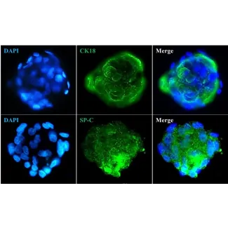 Immunostaining of the human pulmonary alveolar epithelial cell spheroids with the epithelial cell marker CK18 and the specific alveolar epithelial cell type II marker SP-C. 