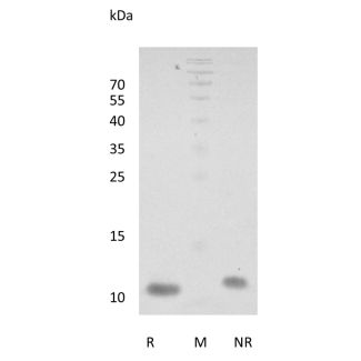 Recombinant Human NRG-1 (EGF-like domain) Beta 2