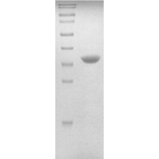 Recombinant Human UbE2R2