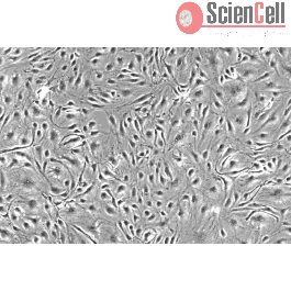 Human Choroid Plexus Endothelial Cells (HCPEC)