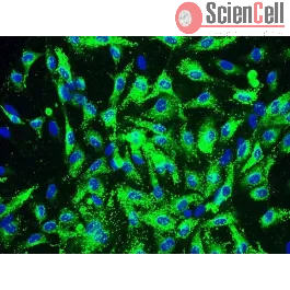 Human Coronary Artery Endothelial Cells (HCAEC )