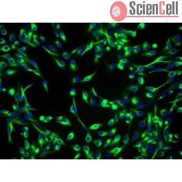 Human Lens Epithelial Cells (HLEpiC)