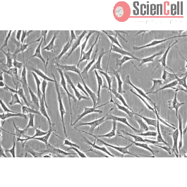 Human Trabecular Meshwork Cells (HTMC)