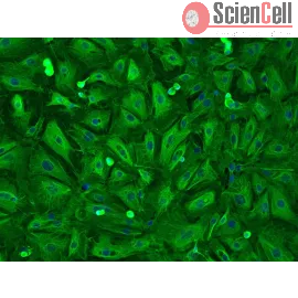 Human Pulmonary Alveolar Epithelial Cells-adult | Sciencell