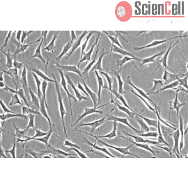 Human Trabecular Meshwork Cells (HTMC) | Sciencell Research...