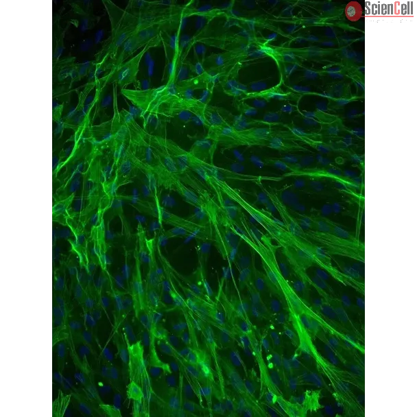 人主动脉平滑肌细胞（HASMC）- α-SMA 免疫染色，200 倍。