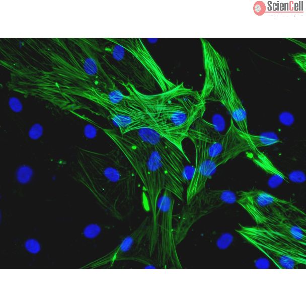 人冠状动脉平滑肌细胞（HCASMC）- α-SMA免疫染色，400倍（400×）
