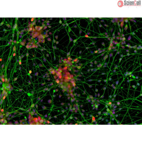 人多能干细胞（hPSC）分化的皮层神经元，经 TBR1（红色）和 β-微管蛋白III（绿色）免疫荧光染色，放大倍数 200×。