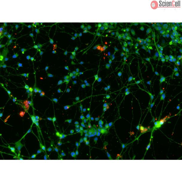 人多能干细胞（hPSC）分化的谷氨酸能神经元，经 vGLUT1（红色）和 β-微管蛋白III（绿色）免疫荧光染色，放大倍数 200×。
