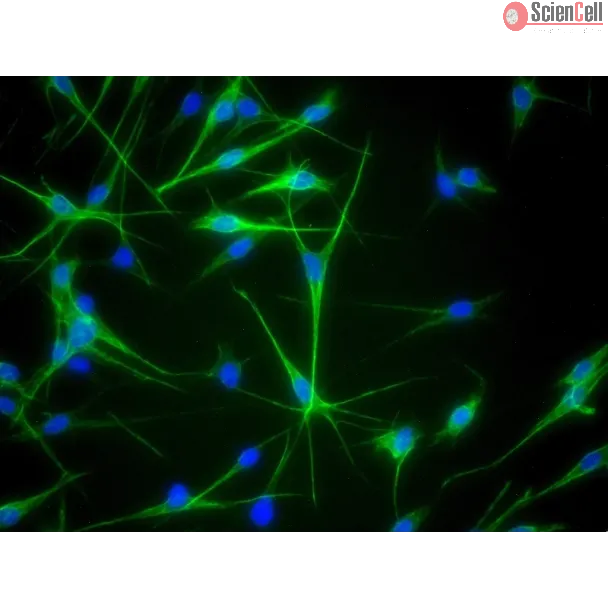 人源表皮黑色素细胞（中等色素型，HEM-m）- S100-β 免疫染色，400×