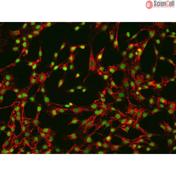 人直肠成纤维细胞（HRecF）- 纤连蛋白（Fibronectin）免疫荧光染色，200×
