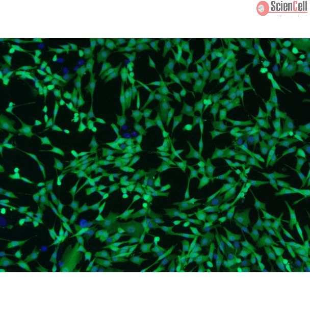 人真皮成纤维细胞-GFP（2310-GFP）– GFP荧光及Hoechst染色，100倍（100×）