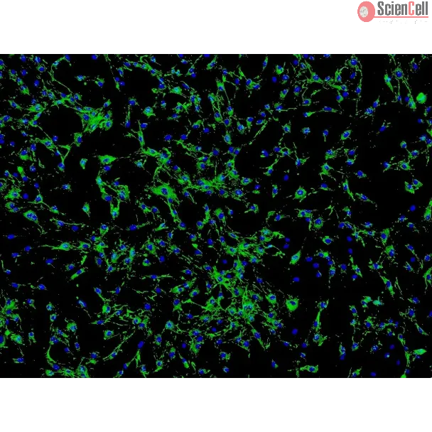 人眼脉络膜成纤维细胞（HOCF）- 纤连蛋白（Fibronectin）免疫染色，100×