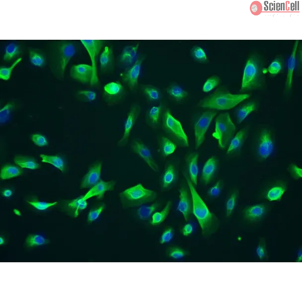 人睾丸间质细胞（HLC）- CK-18 免疫染色，200×
