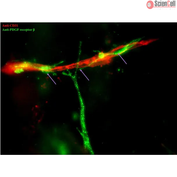 第 6 天；内皮细胞标志物 CD31（红色）和周细胞标志物 PDGF 受体 β（绿色）。紫色箭头表示 PDGF 受体 β 阳性的周细胞附着在 CD31 阳性的内皮小管上（400 倍放大）。