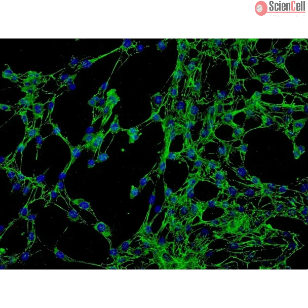 人结膜成纤维细胞（HConF）- 纤连蛋白（Fibronectin）免疫染色，200×