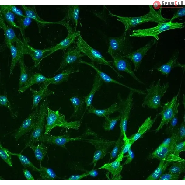 人类肝星状细胞（HHSteC） - α-平滑肌肌动蛋白免疫染色，400倍放大。