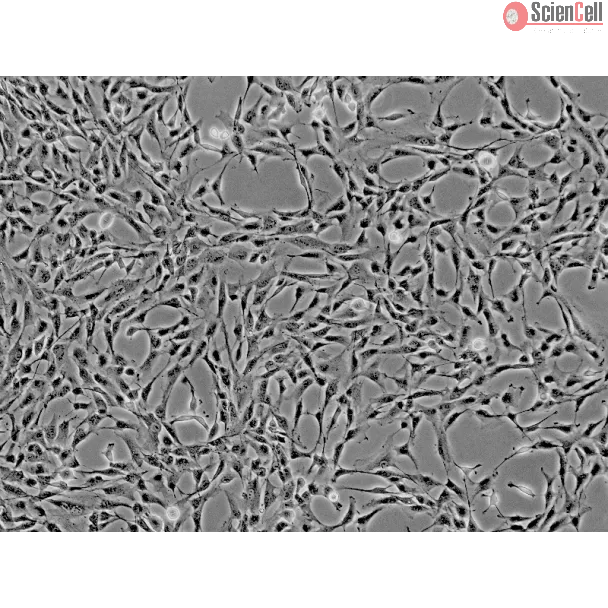 人肝脏间充质干细胞（HMSC-he）—— 相差显微镜，100×。