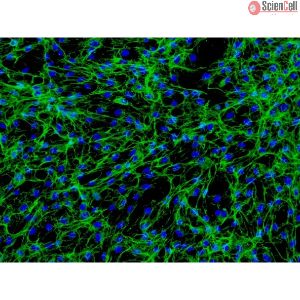 人肠成纤维细胞（HIF）- 纤连蛋白（Fibronectin）免疫荧光染色，200×
