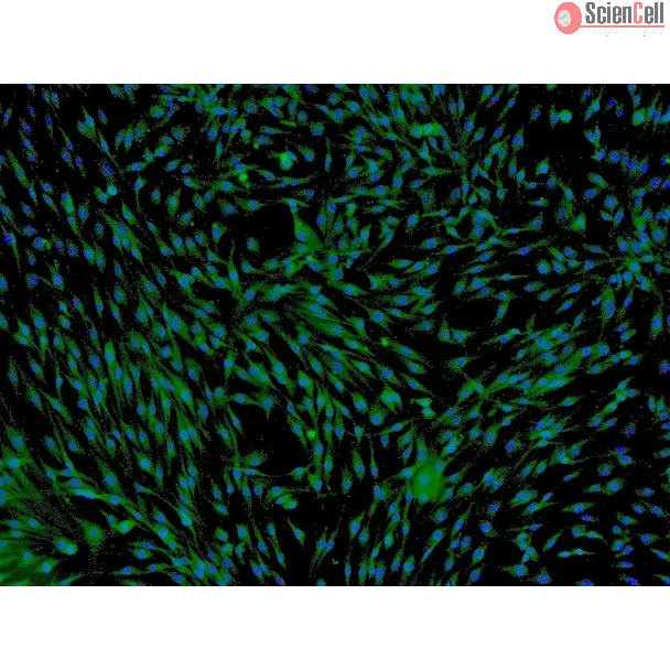 人脂肪间充质干细胞（HMSC-ad）—— CD73 免疫染色，100×。