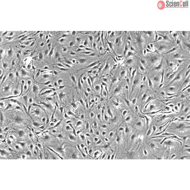 人脉络丛内皮细胞（HCPEC）- 相差显微镜，200×
