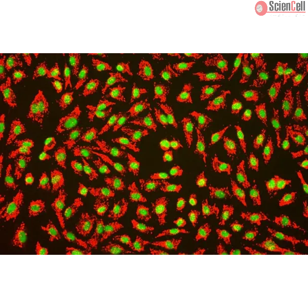 人脐静脉内皮细胞（HUVEC）- vWF 免疫荧光染色（Sigma-Aldrich，产品编号：F3520），200×