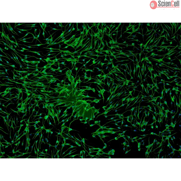 人表皮黑色素细胞-浅色型（HEM-l）- S100-β 免疫染色，100x。