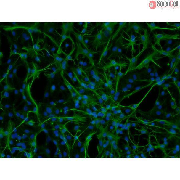 大鼠星形胶质细胞-脊髓（RA-sc）—GFAP 免疫染色，200×