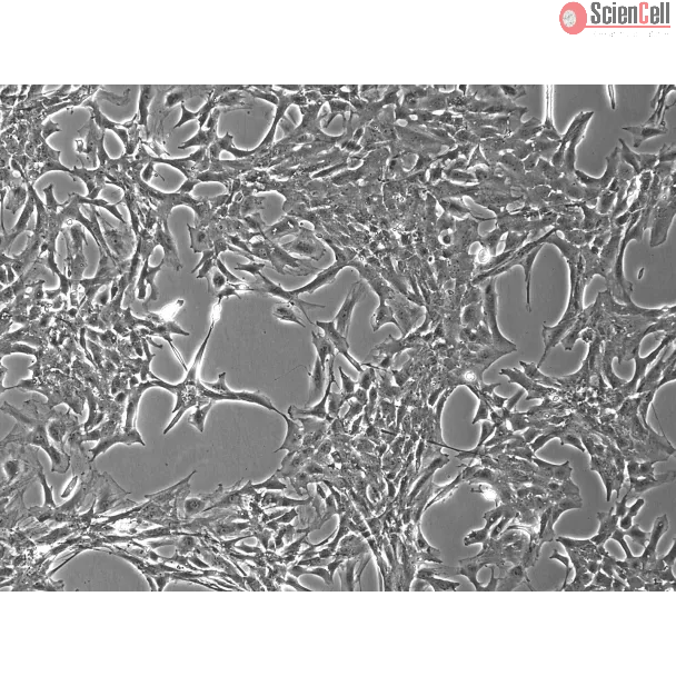 大鼠视网膜星形胶质细胞（RA-r）— 相差显微镜观察，100×。
