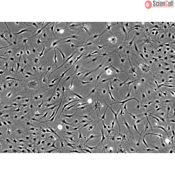 大鼠角膜基质细胞（RK）— 相差显微镜观察，100×。
