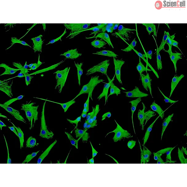 心房心脏成纤维细胞（HCF-aa）- 波形蛋白（Vimentin）免疫染色，200 倍。
