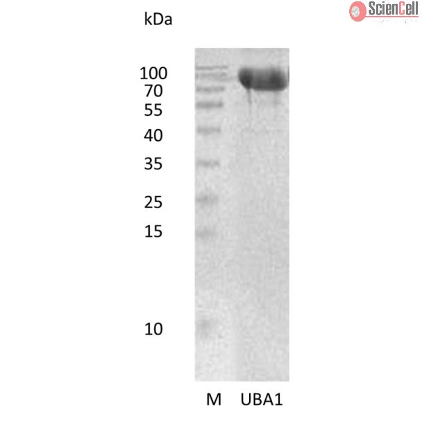 重组人泛素样修饰蛋白激活酶1（UBA1）