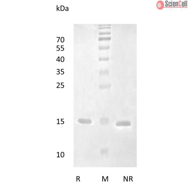 重组人脑源性神经营养因子
