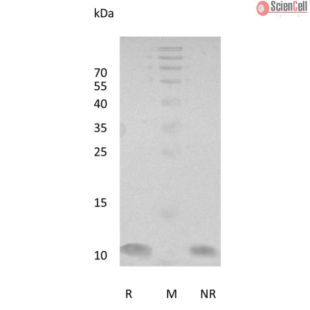重组人NRG-1（EGF样结构域）Beta 1