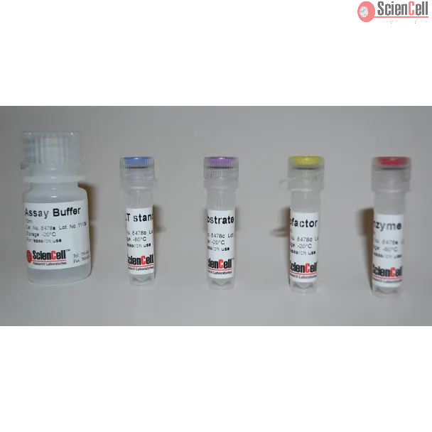 Alanine Transaminase Assay