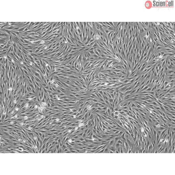 Bovine Brain Microvascular Endothelial Cells (BBMEC) - Phase contrast, 100x
