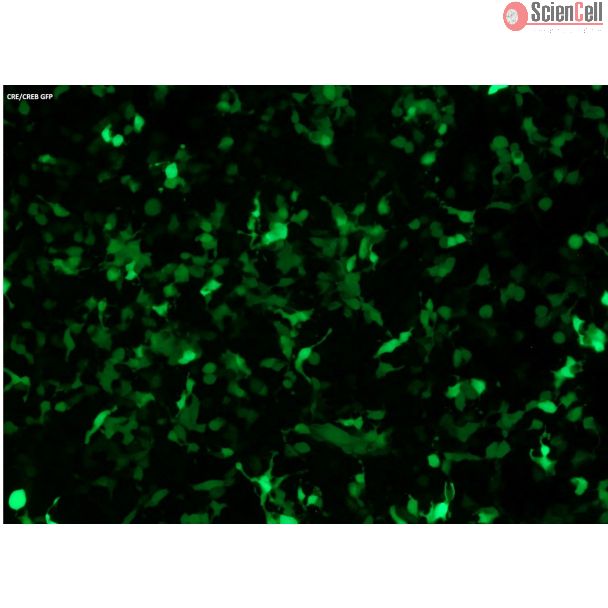 CRE/CREB GFP报告载体转染HEK293T细胞并激活信号通路后的GFP表达（100倍）
