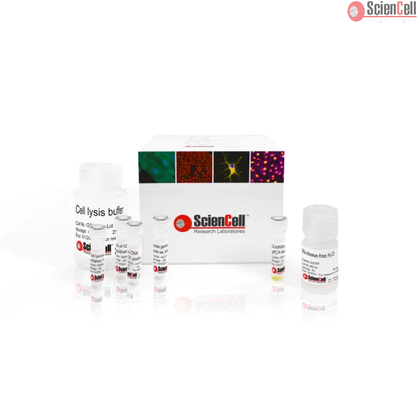 GeneQuery™ HLA-A*02 Screening Kit by qPCR