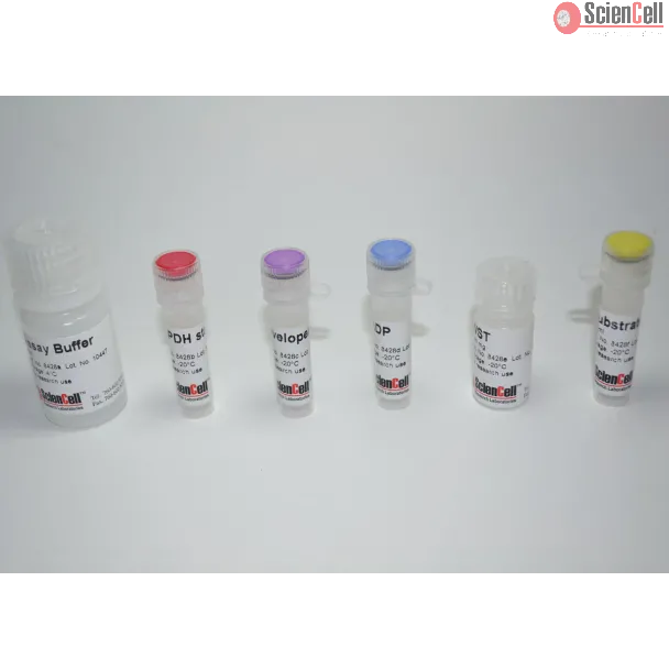 Glucose-6-phosphate Dehydrogenase Assay