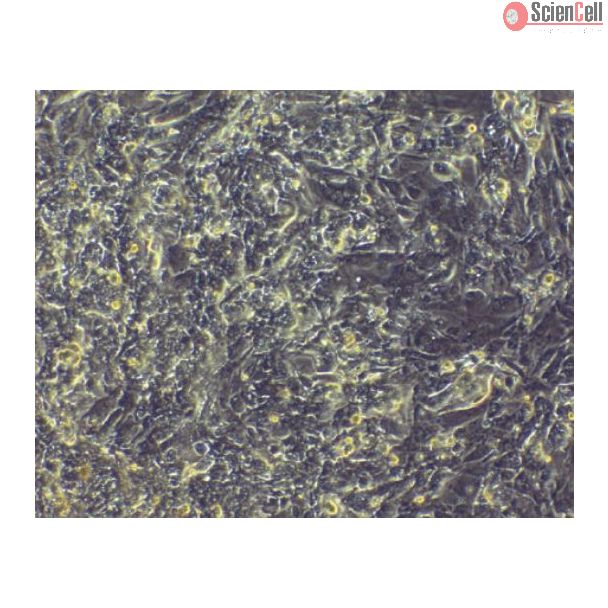 HPSC-derived Cardiomyocytes