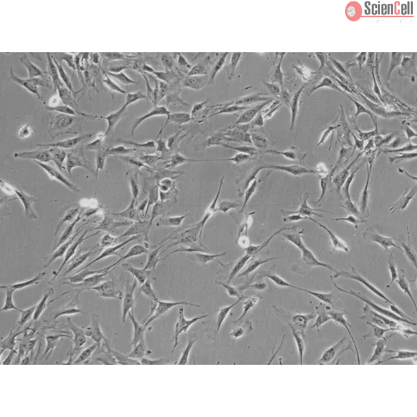 Human Adrenal Cortical Cells (HAdCC) - Phase contrast, 200x.
