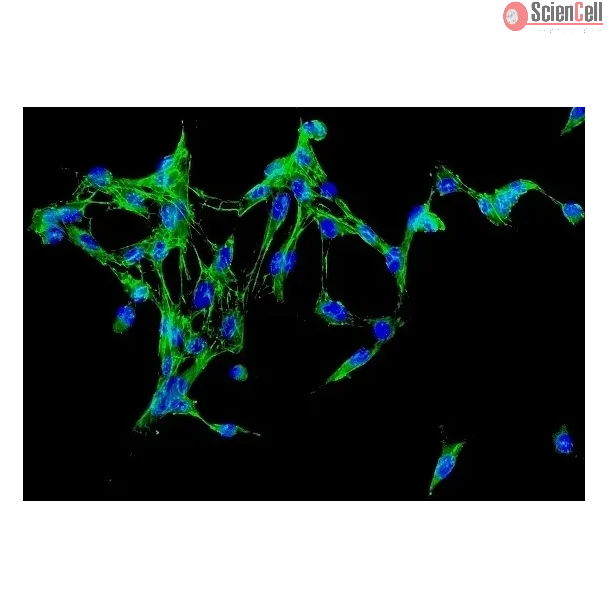 Human Adrenal Fibroblasts (HAdF) - Immunostaining for Fibronectin, 200x.
