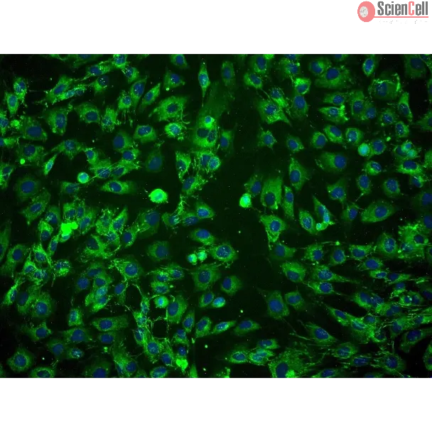 Human Amniotic Mesenchymal Stromal Cells (HAMSC) - Immunostaining for CD105, 200x.
