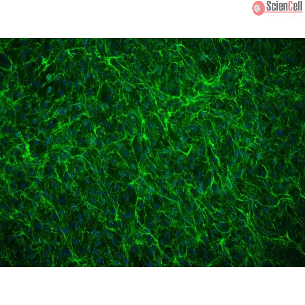 Human Annulus Fibrosus Cells (HAFC) - Immunostaining for Fibronectin, 200x.
